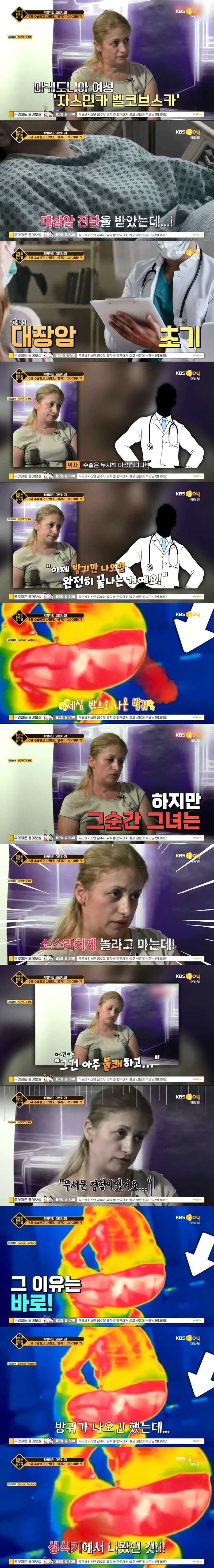 대장암 수술 후 방귀가 생식기에서 나오는 여자.jpg