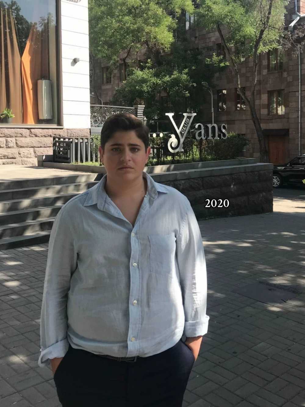 35kg 뺀 사람 비포 & 애프터…